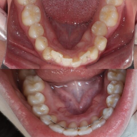 Screenshot_20230811_091054_Photos