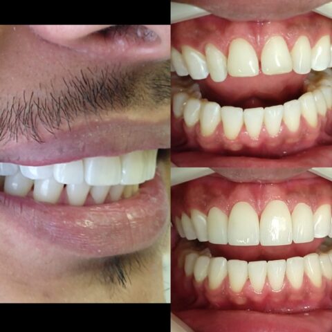 Screenshot_20230811_091322_Photos