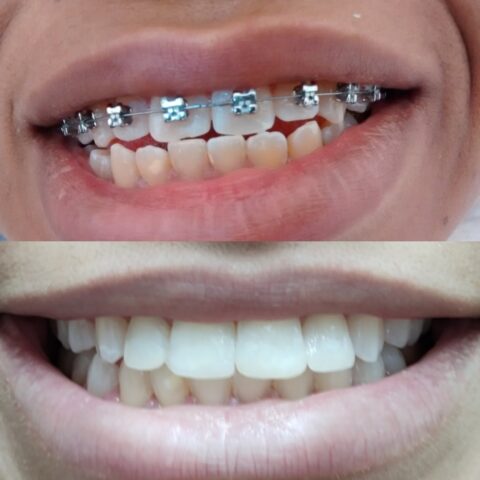 Screenshot_20230811_091547_Photos