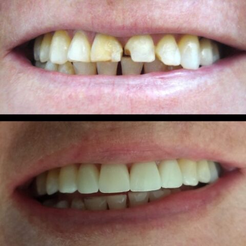 Screenshot_20230811_091600_Photos