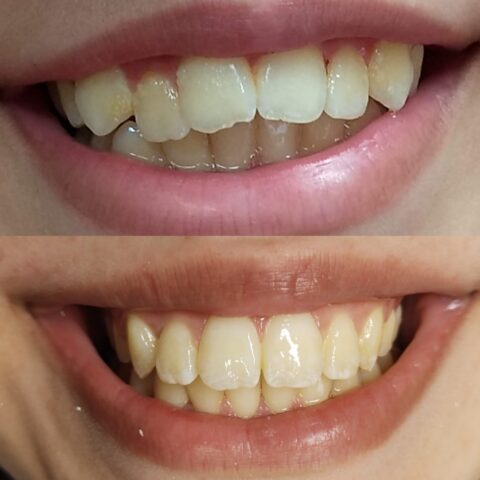 Screenshot_20230811_091636_Photos