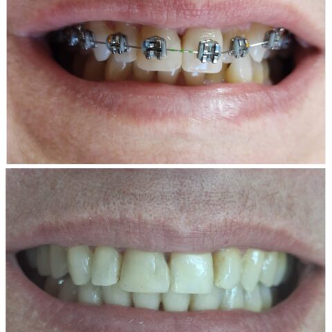 20250618_070001-COLLAGE