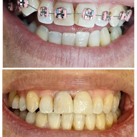 20250618_070155-COLLAGE