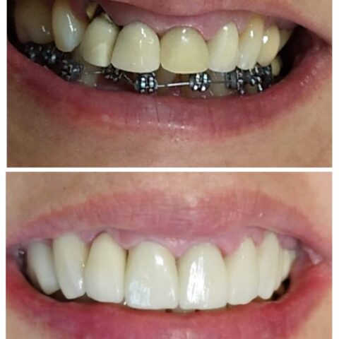 20250618_070234-COLLAGE