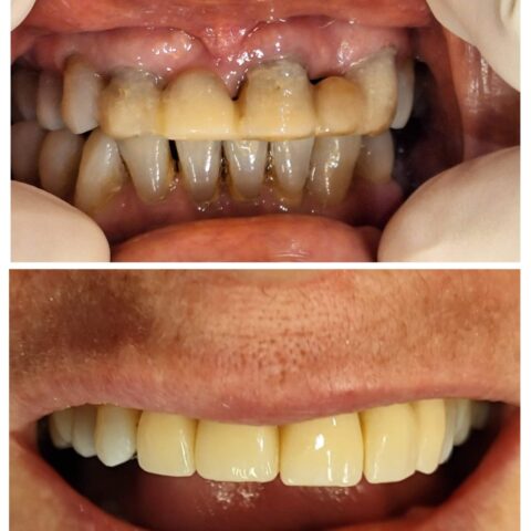 20250618_070331-COLLAGE