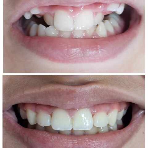 20250618_070401-COLLAGE