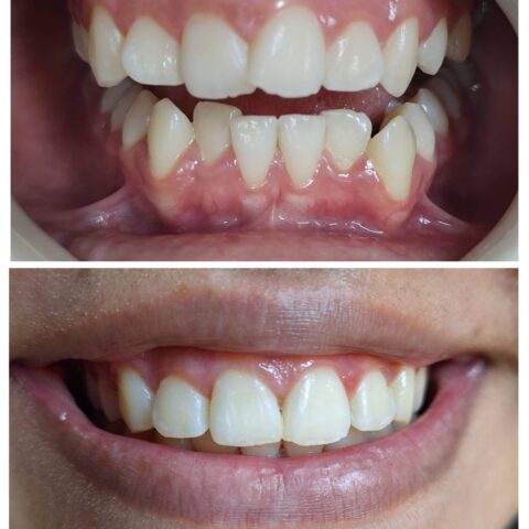 20250618_070456-COLLAGE