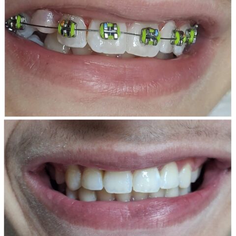 20250618_070618-COLLAGE