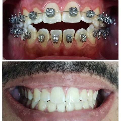 20250618_070700-COLLAGE