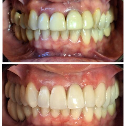 20250618_070844-COLLAGE