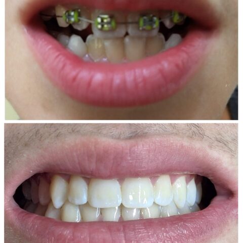 20250618_071107-COLLAGE