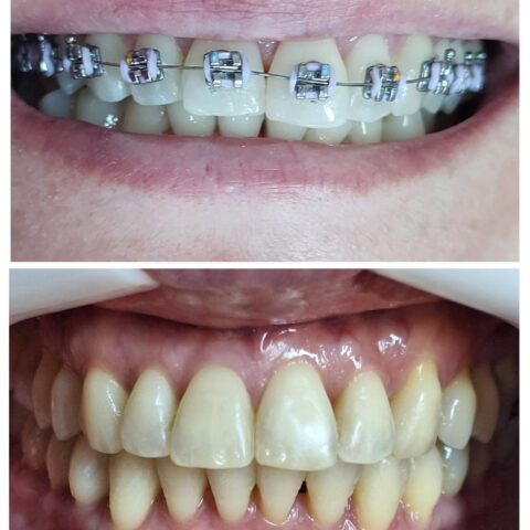 20250618_071209-COLLAGE