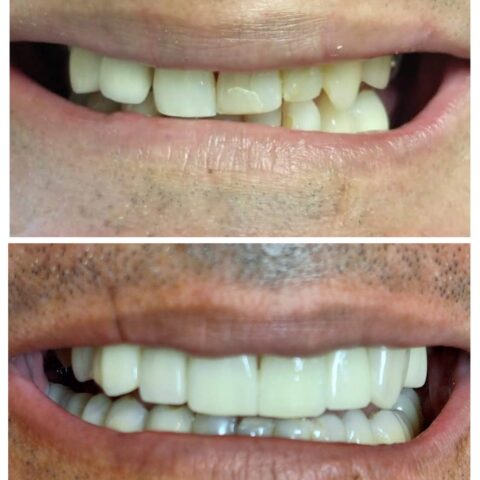 20250618_071342-COLLAGE