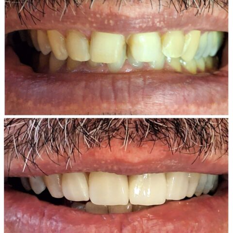 20250618_071515-COLLAGE