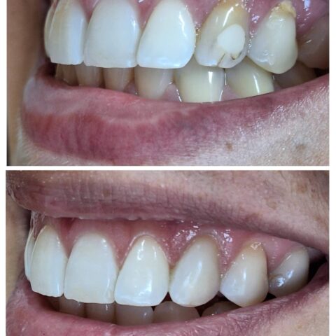 20250618_071702-COLLAGE