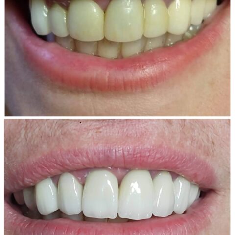 20250618_071844-COLLAGE