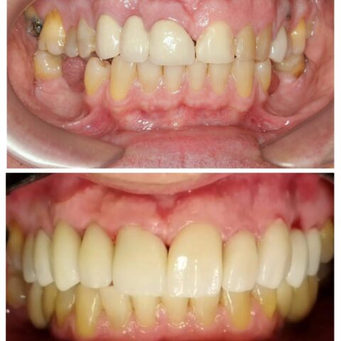 20250618_071926-COLLAGE