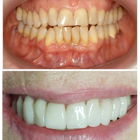 20250618_072048-COLLAGE