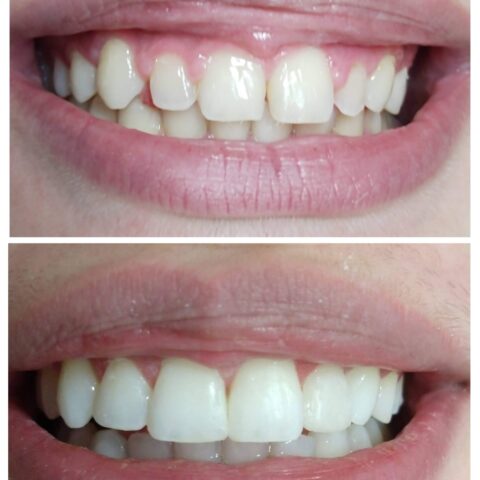 20250618_072126-COLLAGE