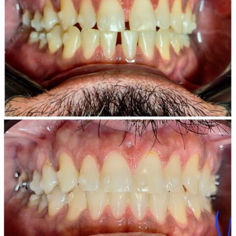 Screenshot_20250618_070111_Photos