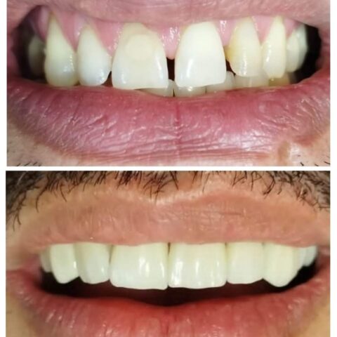 Screenshot_20250618_071601_Photos